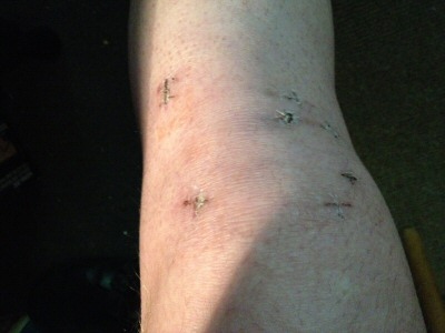 Knie